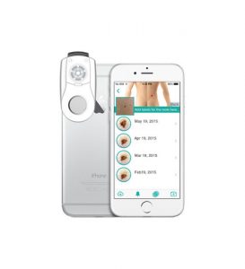 MoleScope for iPhone 5.
