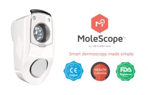 MoleScope for Skin Cancer Detection