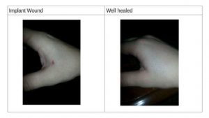 Wahle's hand. (Image via Forbes)