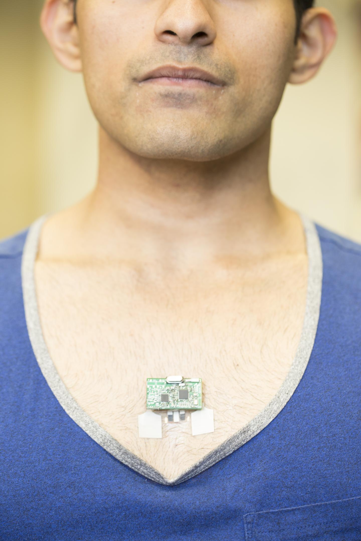 The ChemPhys patch can be worn on the chest, near the base of the sternum. (Image Credit: Jacobs School of Engineering/UC San Diego