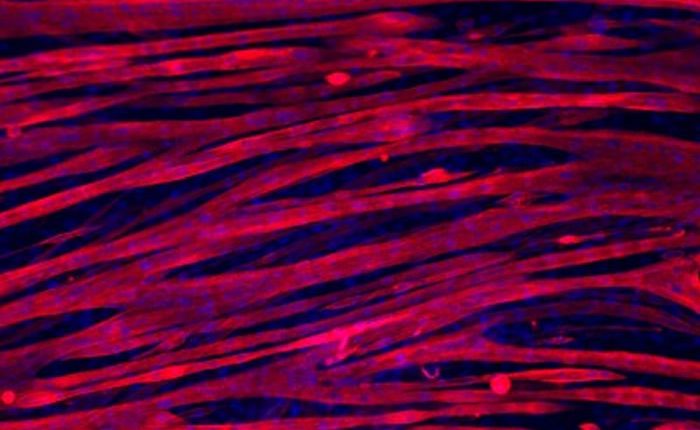 Skeletal myotubes grown for three weeks on gelatin hydrogel. Credit: Archana Bettadapur, Gio Suh, Evelyn Wang, Holly Huber, Alyssa Viscio and Megan McCain