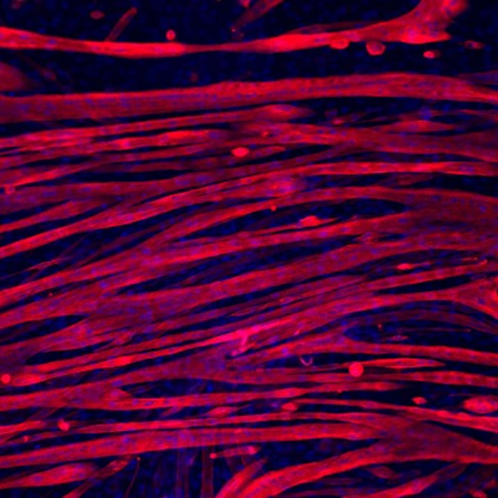 Skeletal myotubes grown for three weeks on gelatin hydrogel. Credit: Archana Bettadapur, Gio Suh, Evelyn Wang, Holly Huber, Alyssa Viscio and Megan McCain