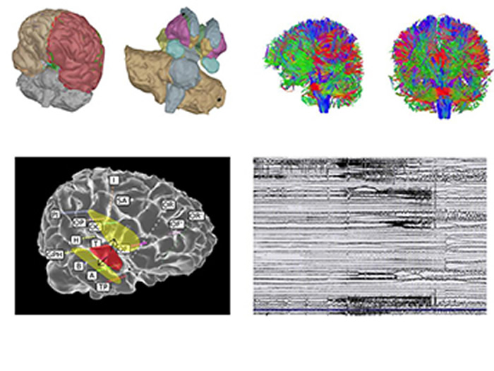 Image: These simulations allow digital testing of new therapeutic strategies. Credit: INS UMR1106 INSERM/AMU