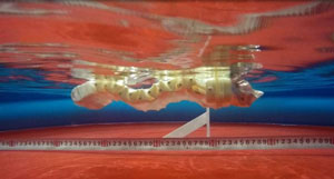 intestines