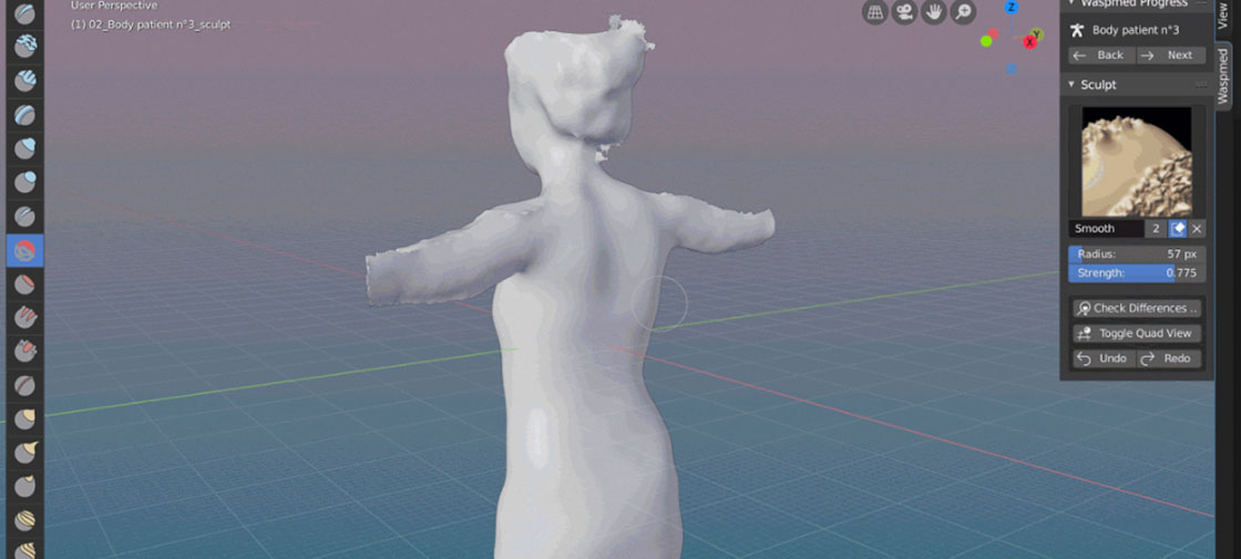 Open Source Software Developed For 3D Orthopedic Prints Open Source Software Developed For 3D Orthopedic Prints