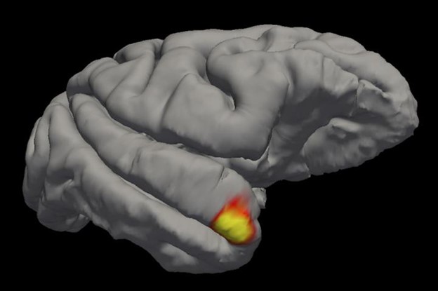 IMAGE: An area (red/ yellow) in the brain's temporal pole specializes in familiar face recognition. Credit: Sofia Landi