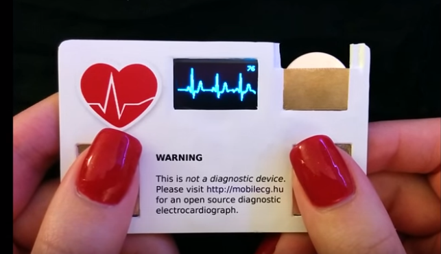 MobileECG