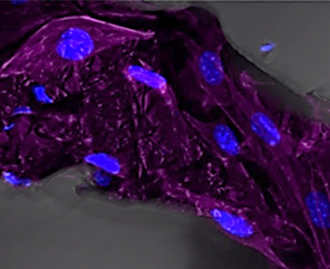 Confocal fluorescence microscope image of C2C12 myoblasts on graphene foam. Credit: Boise State University