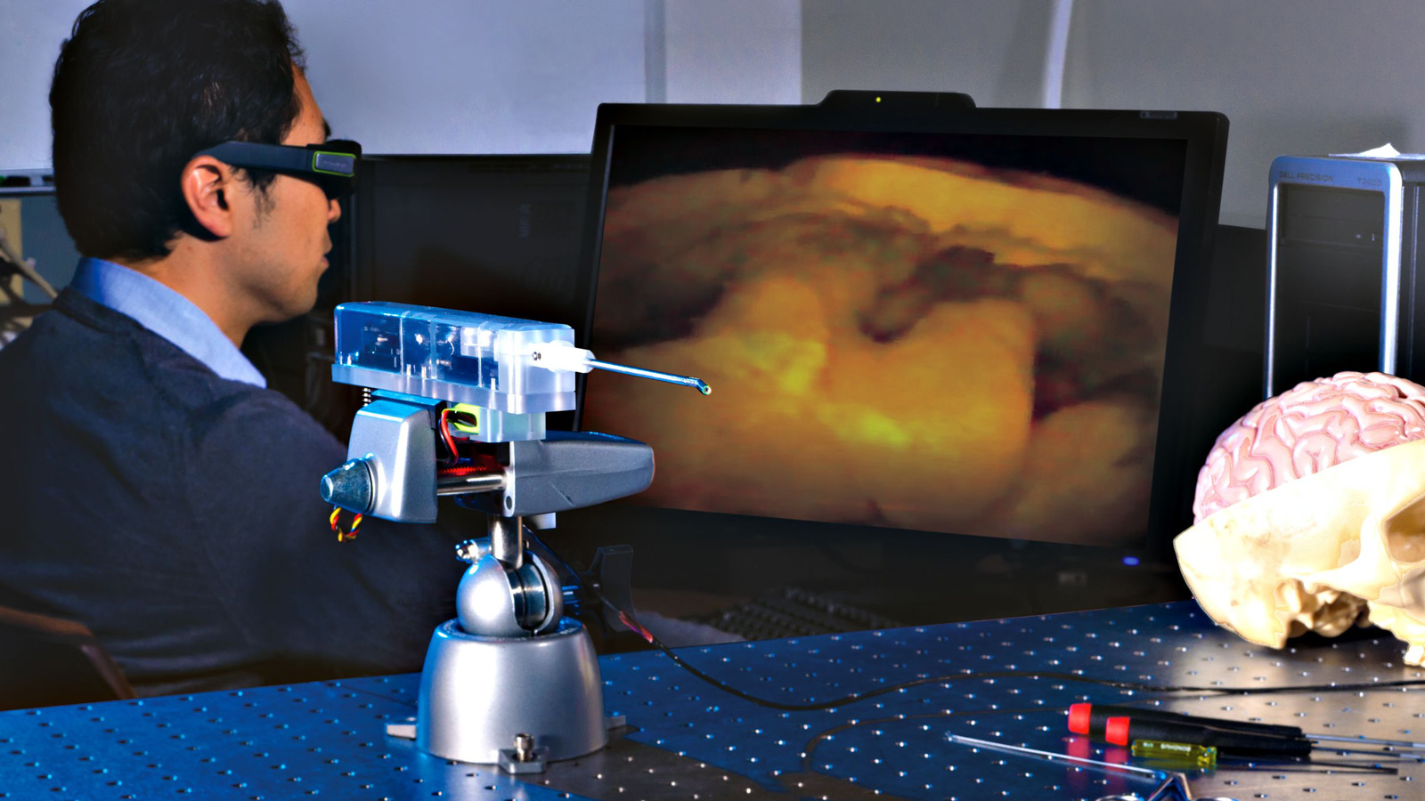 Smallest 3-D Camera Offers Brain Surgery Innovation