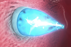 The non-invasive device. (Image credit: Boston Children's Hospital)